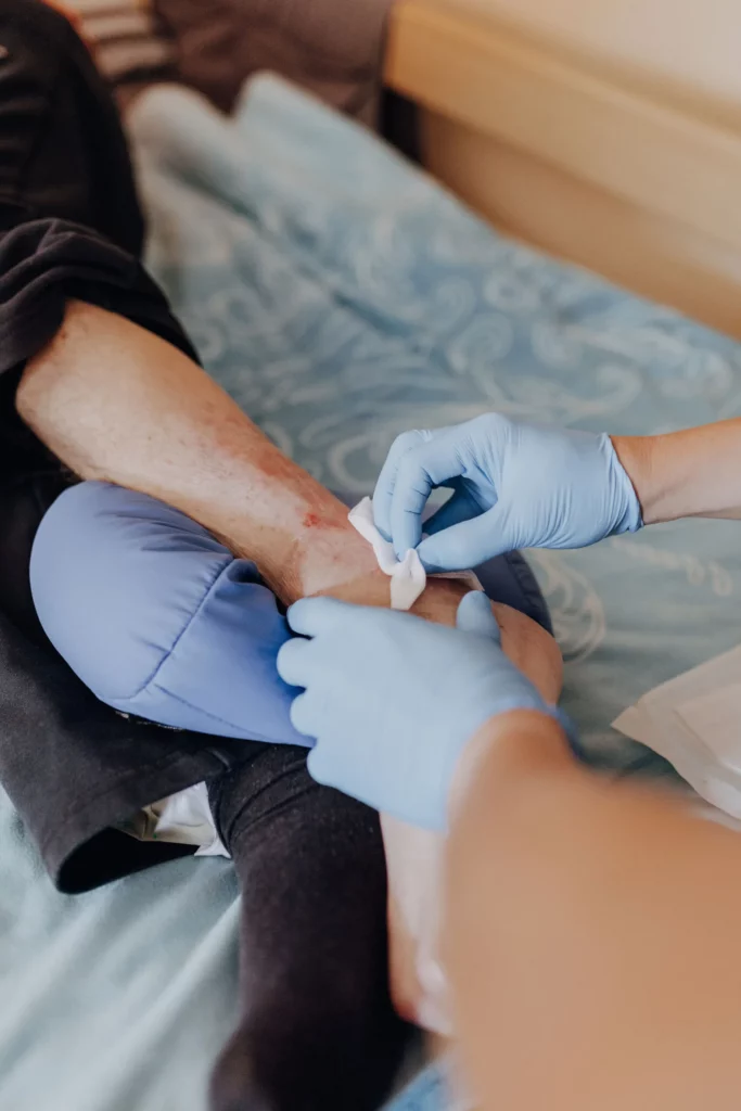 Eine Homecare-Fachkraft mit blauen Einweghandschuhen versorgt die Wunde eines Patientin mit medizinischen Hilfsmitteln.